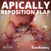 APICALLY REPOSITION FLAP