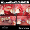 ONLINE MASTERCLASS of SOFT TISSUE MANAGEMENT In BONE GRAFTING PRE-LAUNCH DISCOUNT -70%